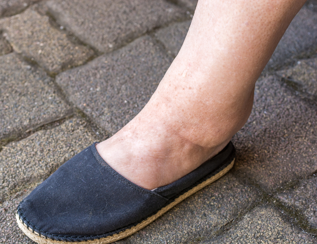 Still Swollen 3 Weeks After Delivery? Here’s Why It Happens