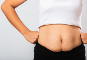 Targeted Recovery Techniques